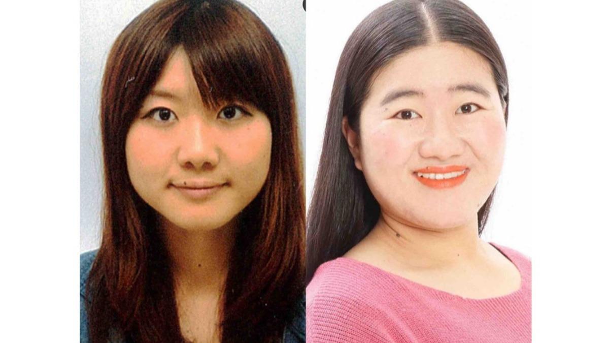 經紀人1句話救命!日女星「四肢、鼻子變大」 竟是罹罕見腫瘤