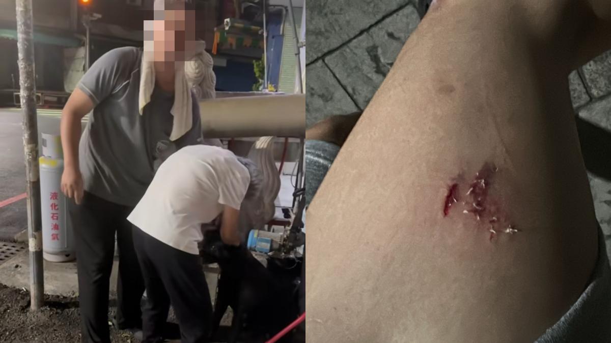 男遇同條瘋狗攻擊!腿噴血皮開肉綻 飼主:咬人是牠自由