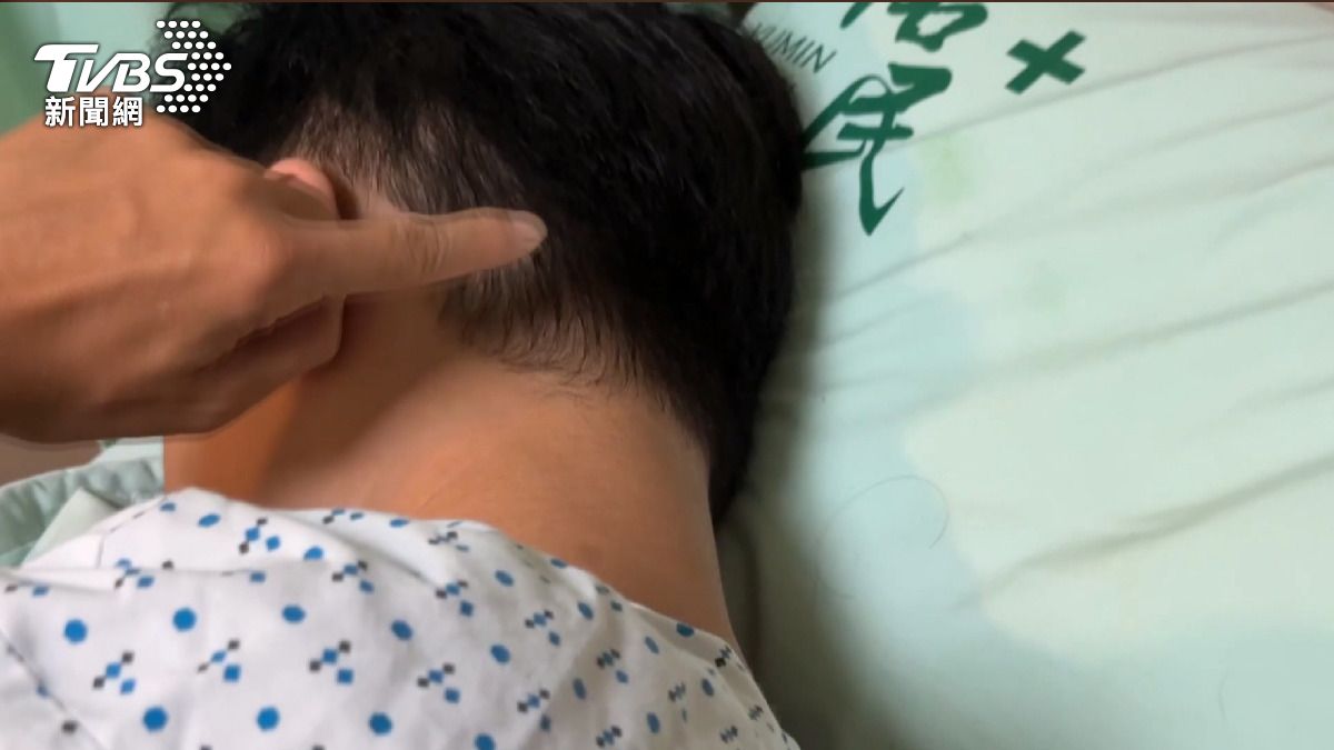 引擎聲惹怒鄰!草屯男遭球棒狠砸顱內出血 打人男:他嚇到我了。(圖/警方提供)