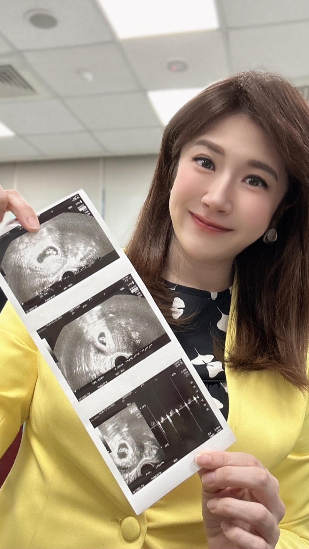 主播鄭亦真宣布懷孕。(圖/翻攝鄭亦真臉書)