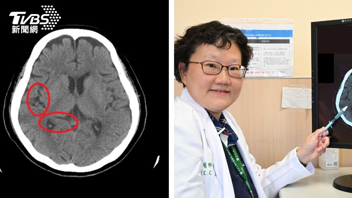 台中翁懷疑媳婦偷錢又下毒!大腦萎縮異常 醫揭真相