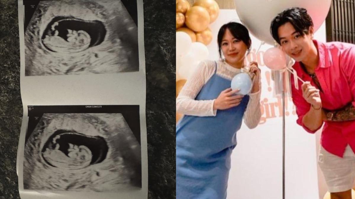 女兒還不滿1歲!高爾宣報喜升格二寶爸 辣妻曬孕肚預產期曝光