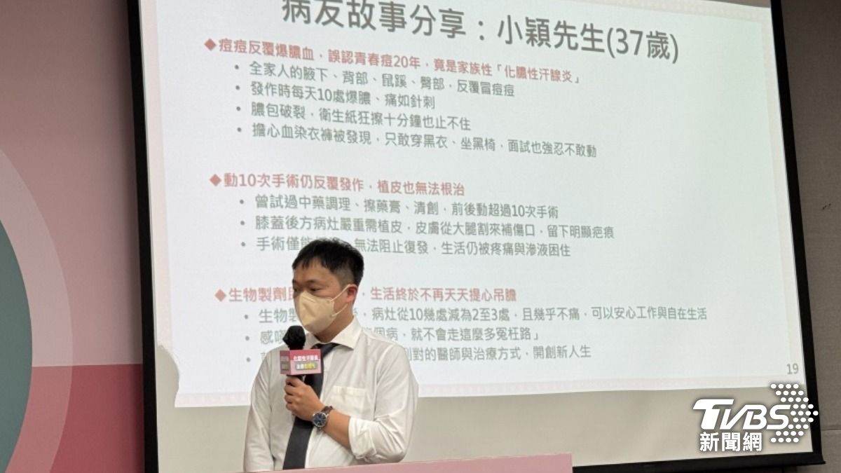 私密部位冒痘20年!他確診「化膿性汗腺炎」 醫曝1情況是關鍵