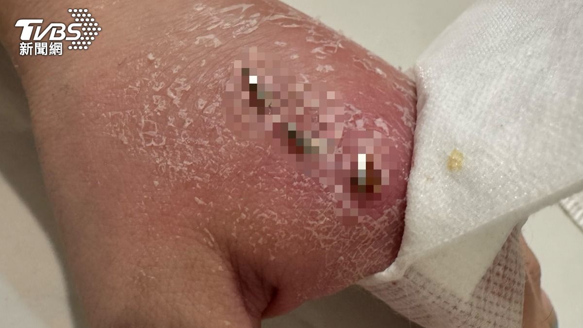 遭連賞巴掌、掐脖撞牆!女控前男友施暴 見信義割喉案:我怕沒明天