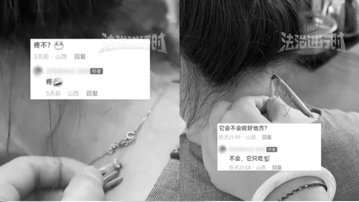 脖子後長病毒疣!陸女「抓螳螂讓牠吃掉」:像針扎一樣