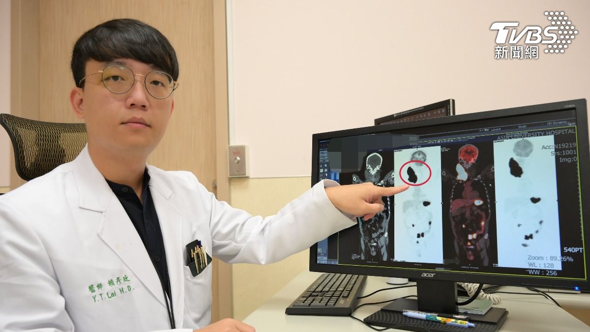 亞洲大學附屬醫院血液腫瘤科主治醫師賴彥廷。(圖/TVBS)