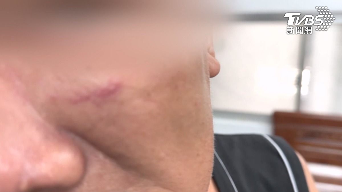 受害清潔員蘇先生帶著臉上明顯傷痕現身說明經過,落淚表示無法接受在辛勤工作時遭受如此不公平對待。(圖/TVBS)