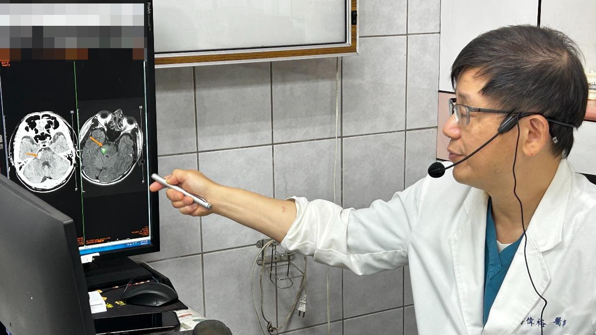 李偉裕解釋,腦幹出血致死率極高,「10位患者有9位會致死,剩下一位恐就是植物人或重殘癱瘓」。(圖/大甲李綜合醫院提供)