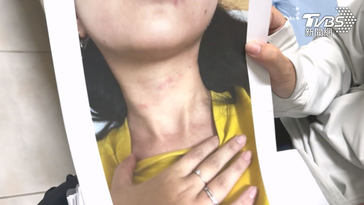 馬小姐說遭到前男友家暴，脖子出現掐痕，失控舉動讓她嚇壞了（圖／TVBS）