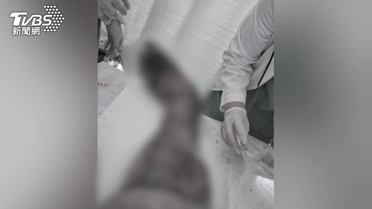 37歲賀先生因罹患象腿症而生活困難,他的雙腿腫脹且幾乎全部潰爛。(圖/民眾提供)