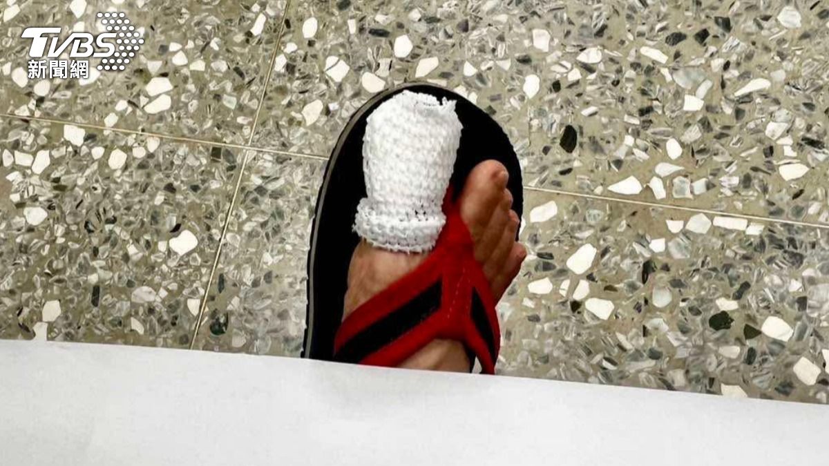 台南婦穿拖鞋逛市場遭鼠咬　「腳趾一陣劇痛」滲血