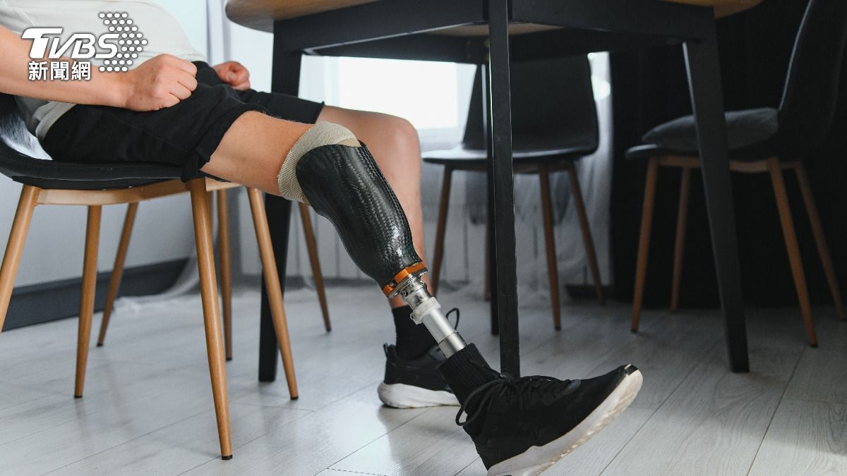 父親罹糖尿病截肢!親友勸「帶回斷腳」:人走的時候才算全屍