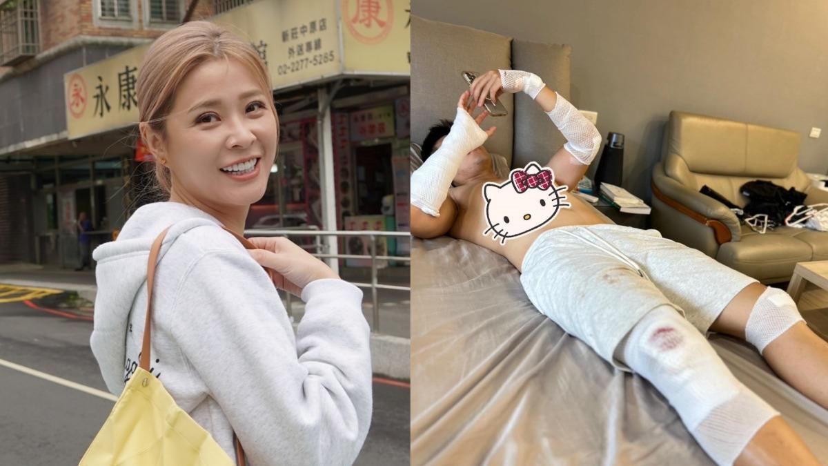 李燕爆哭!外甥自摔翻5圈「包成木乃伊」 送醫崩潰操碎了心