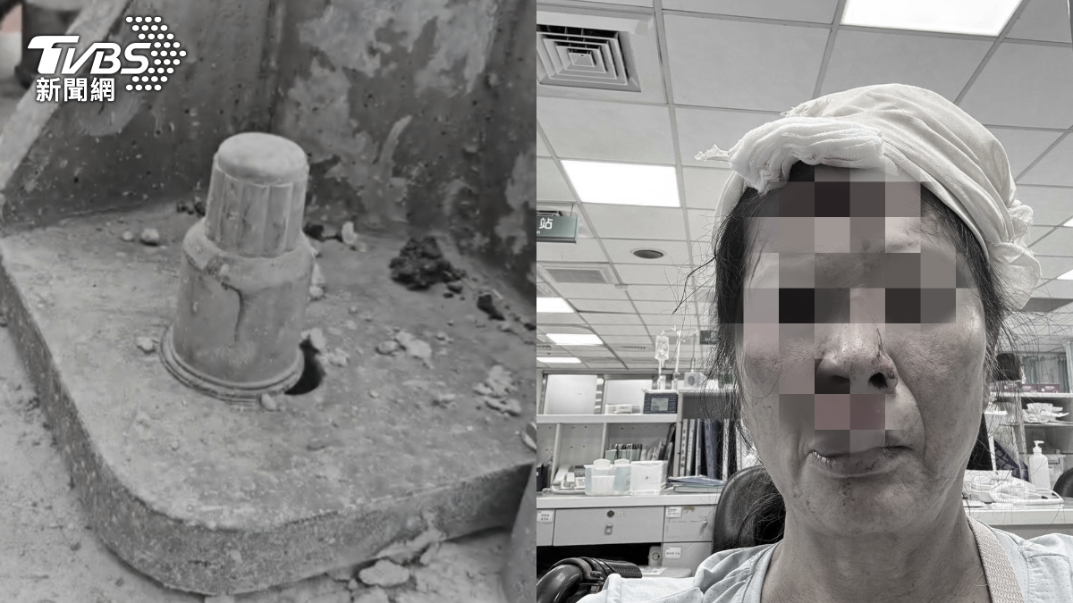 路燈螺絲成安全隱患…曾害台中童枉死 又有婦插臉染血毀容