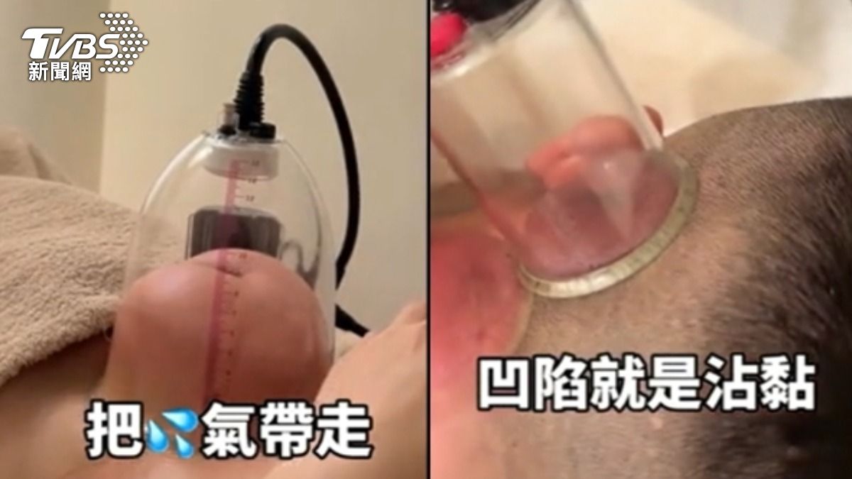部分美容SPA店提供「負離子活罐」服務，衛福部表示手法看起來在灰色地帶。（圖片來源／業者Threads）