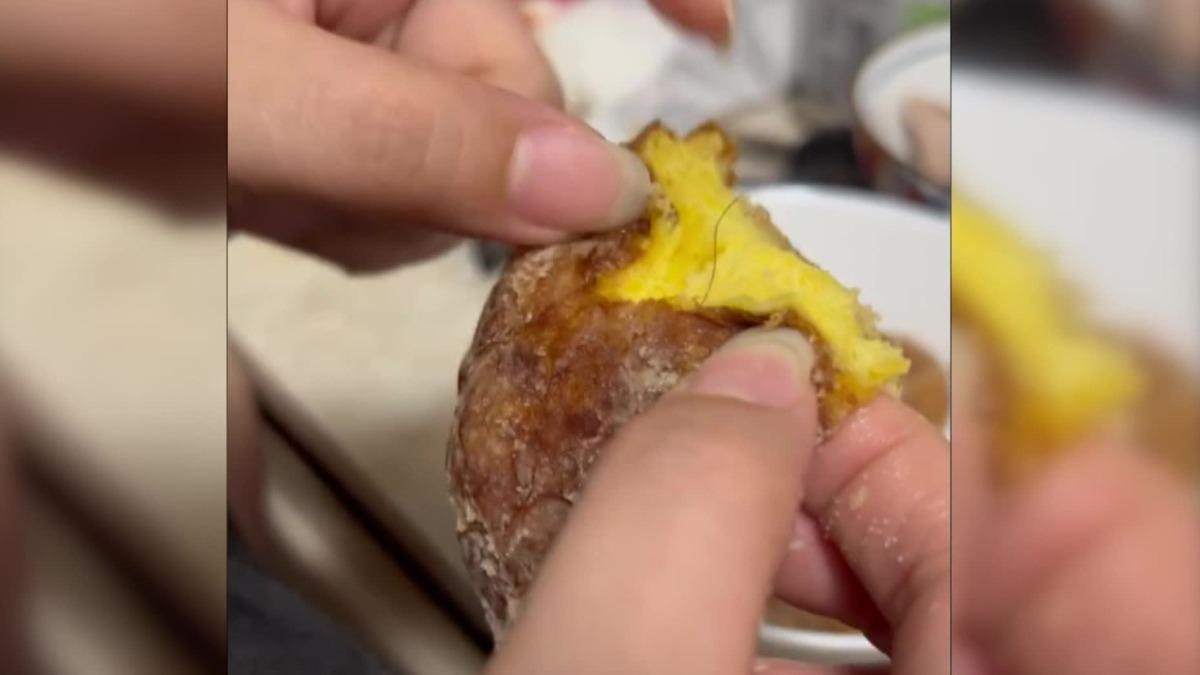日系甜甜圈長黑毛拔不出。(圖/huelshd Threads)