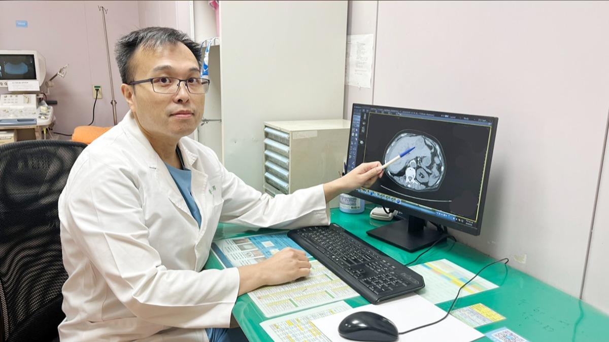 林俊男抽血、急診超音波檢查,發現阿嬤腹腔有積液情形,將成分抽出驚見10CC血液。(圖/澄清醫院中港院區提供)