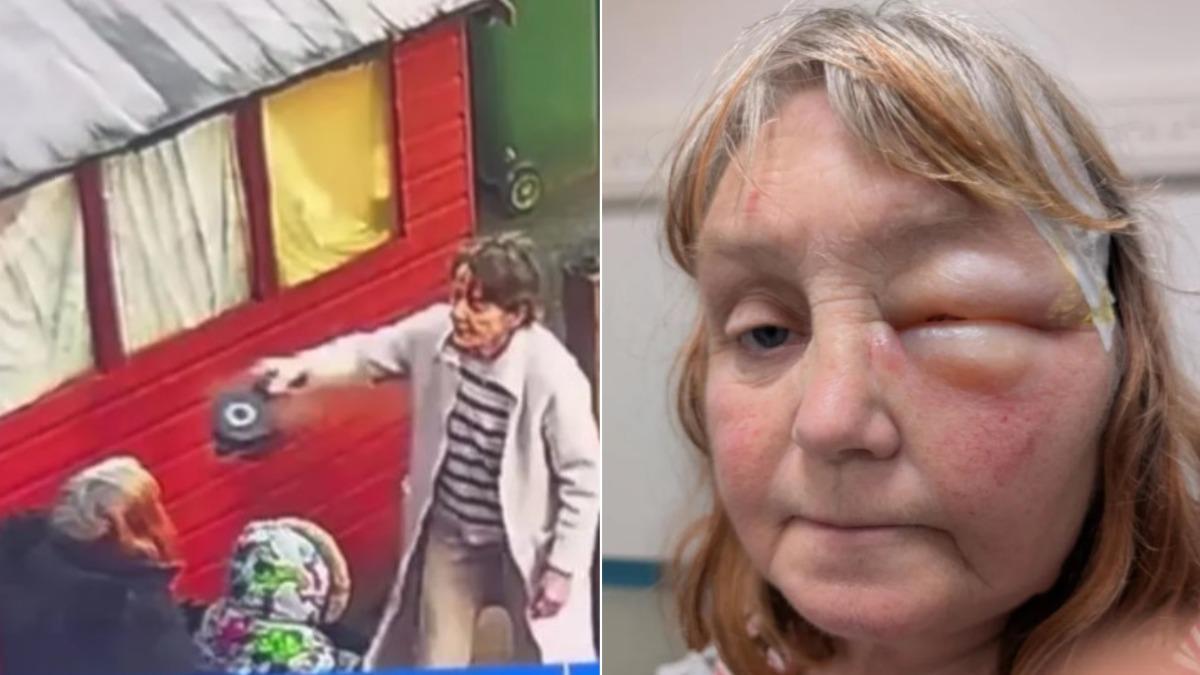 恐怖鄰居拿滾燙熱水朝臉猛潑! 英老婦「起超大水泡」險失明