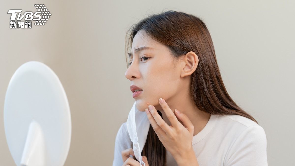 28歲女痘痘冒不停!「這部位」竟跟便祕有關 調理半年改善超有感