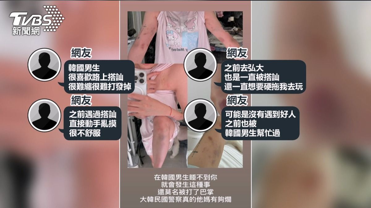 台YTR拒搭訕遭韓男毆打!全身瘀青手指骨折 弘大搭訕施暴非首次。(翻攝YT Sean Solo)