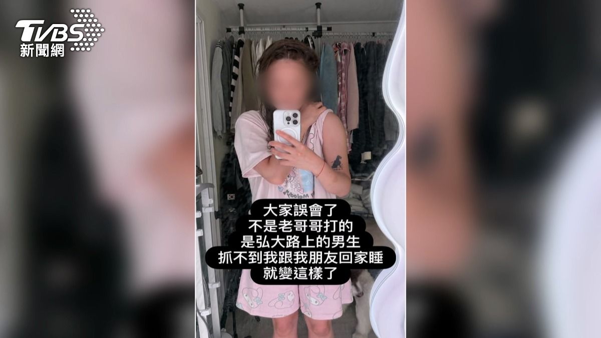 台YTR拒韓男搭訕遭毆 全身瘀青手指骨折。(翻攝YT Sean Solo)