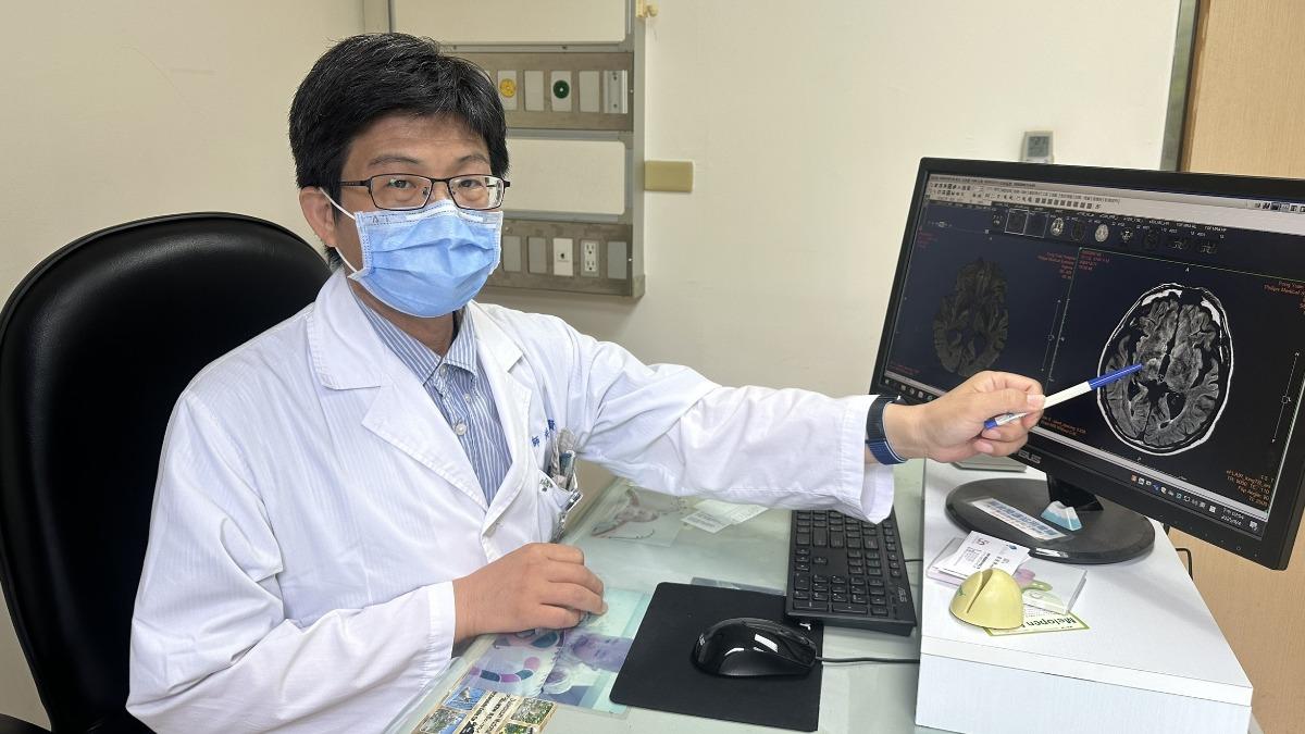 洪朝賢表示,臨床上這類「非典型中風症狀」確實存在,但十分少見。(圖/豐原醫院提供)