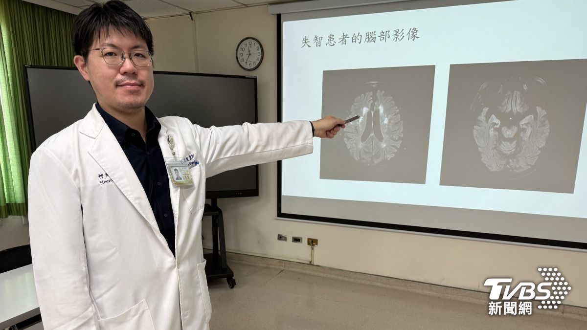 王星翰說明，據衛生福利部統計，2024年台灣65歲以上長者失智盛行率達8％。（圖／林冠丞攝）