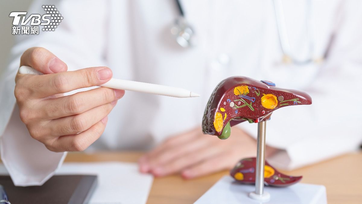 肝癌嬤喝「地瓜葉洋蔥汁」腫瘤消失　醫：脂肪肝是健康最大未爆彈
