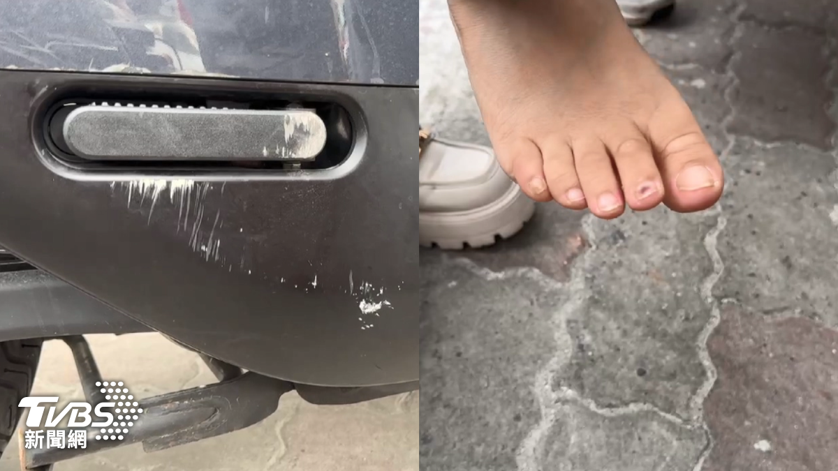 對方是在逆向行駛的狀態下撞倒她的車,導致電動車車殼多處刮痕,腳部瘀青。(圖/TVBS)
