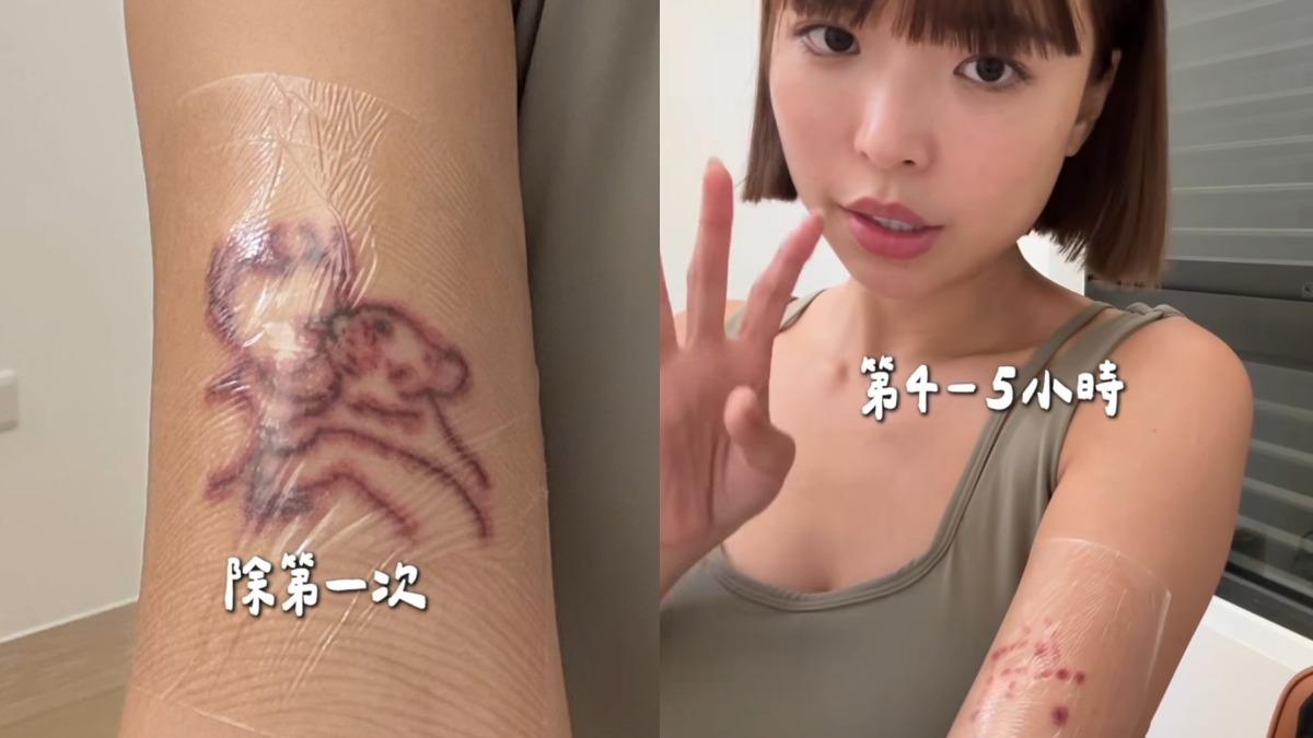 阿圓分享除刺青的效果。（圖／翻攝自Instagram／nanaciaociao）