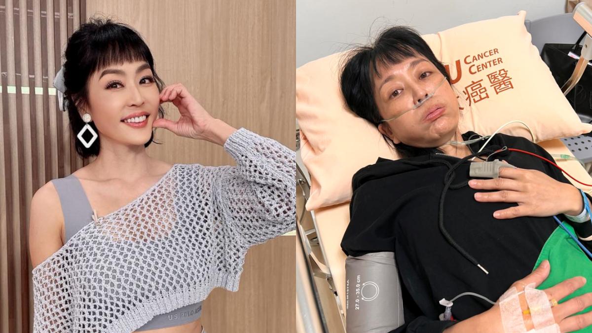 癌末摘光子宮卵巢！女星術後6年才知「膽囊不見了」：嚇得魂飛魄散