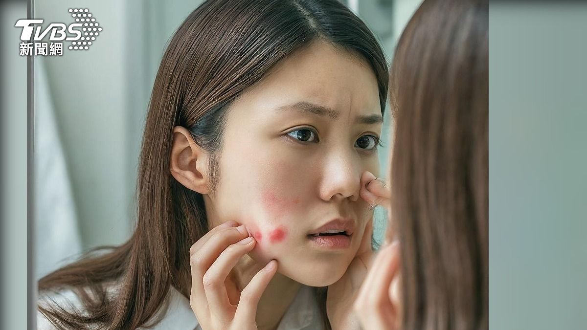 痘痘濕疹可能是腸胃拉警報 「腸生不老茶」助根治又保健