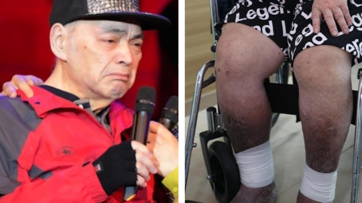 羅浩楷呼籲大家要多照顧年老演藝人。(圖/香港01提供)