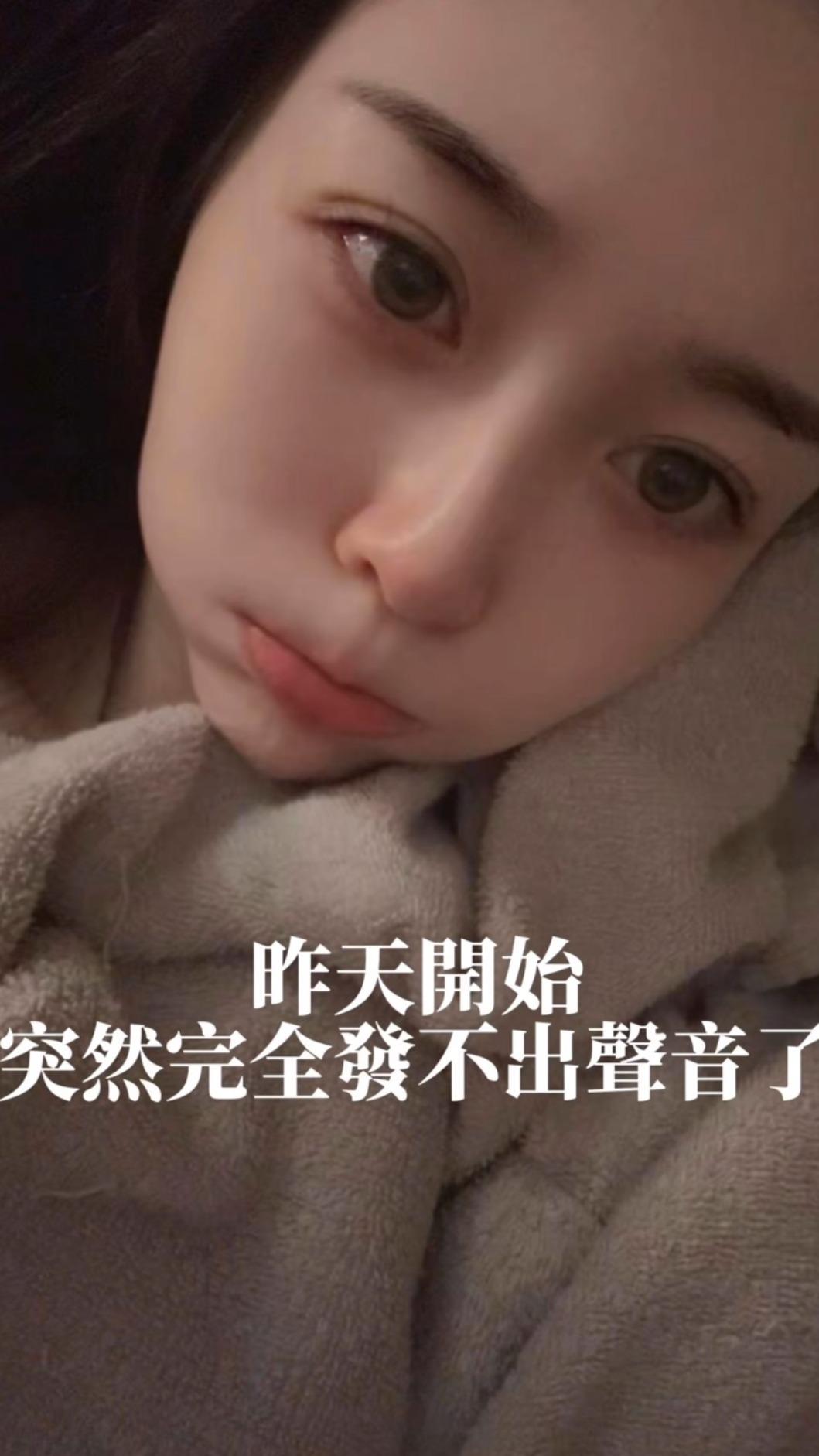 Albee在影片中表示「昨天開始突然完全發不出聲音了」，聲帶似乎出了一點狀況。（圖／翻攝自IG @albeefin）