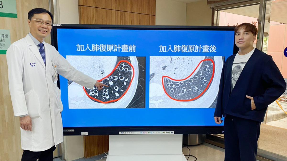 甘男（右）加入肺復原計畫，每天在家有效排痰20分鐘，情況大幅改善。（圖／台中榮總提供）