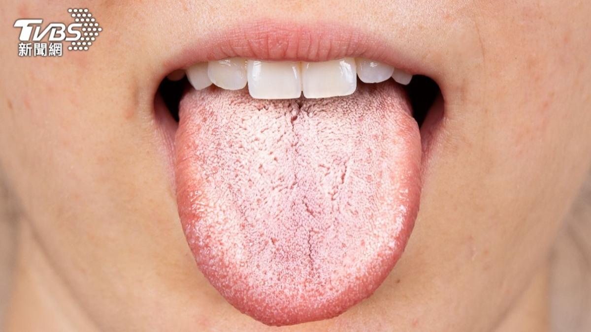 起床發現舌苔變厚、發黃?醫示警5症狀別輕忽:身體開始癌變