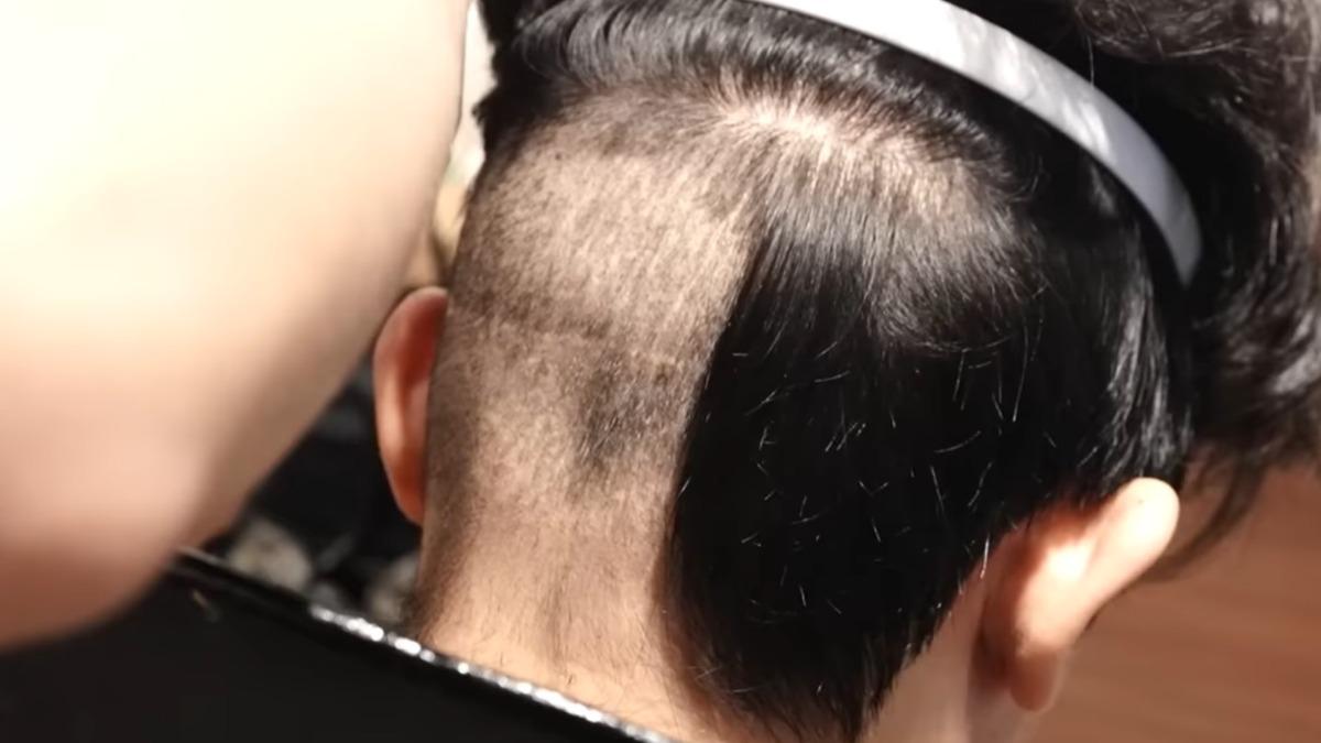 酷炫曾在個人YouTube頻道記錄自己第四次植髮的過程。(圖/翻攝自酷炫老師Youtube)