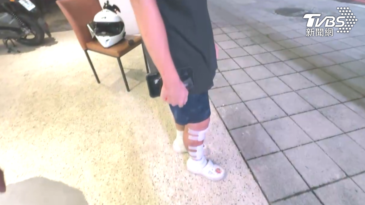 所幸騎士意識清楚,只有身體多處擦挫傷,經過包紮後不需要送醫。(圖/TVBS)