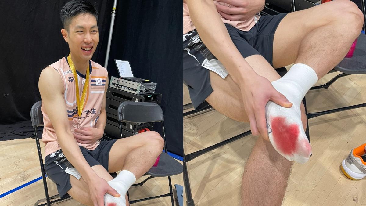為了孩子們!周天成北極賽2連霸 「浴血而戰」腳底水泡染紅白襪