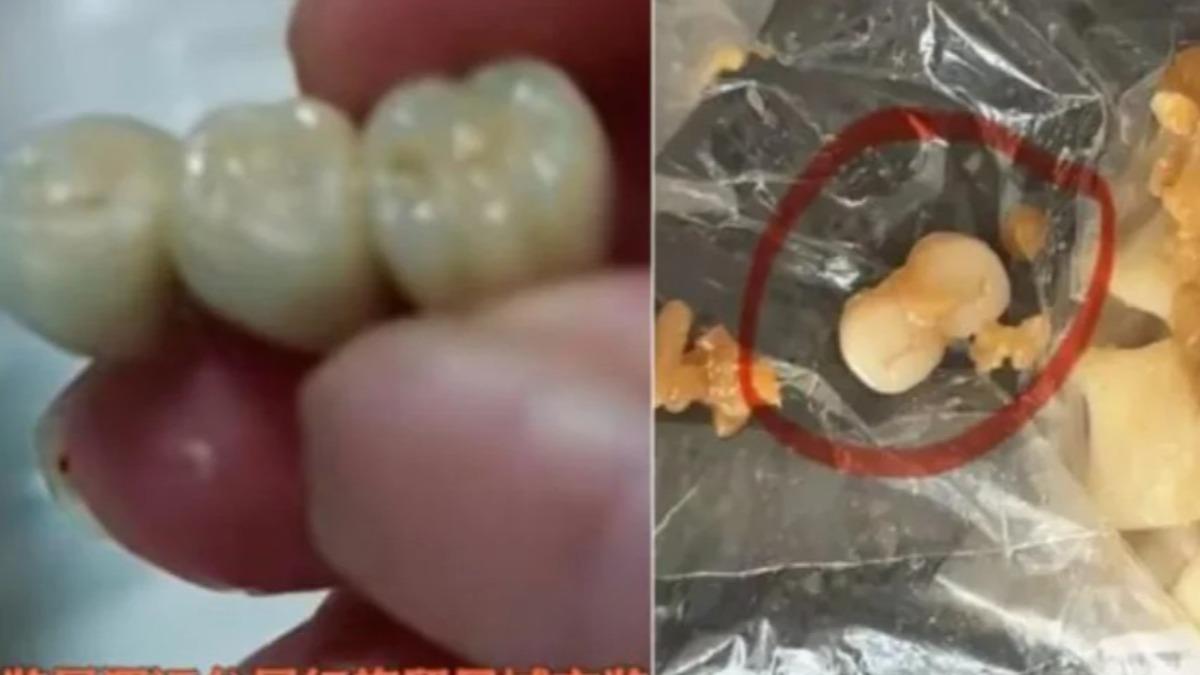 陸女吃香腸「咬到3顆牙」!一票反胃噁心 見失蹤人口:毛骨悚然