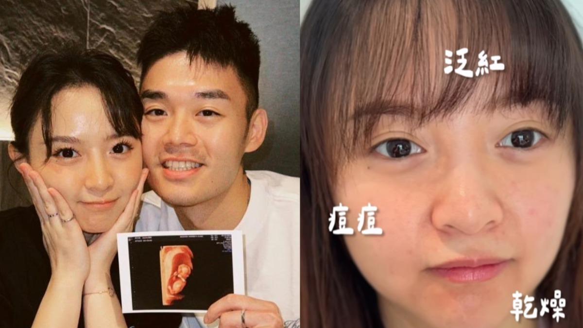 王齊麟愛妻孕後3點變了！　陳詩媛曬「驚人素顏照」嘆：以前都不會