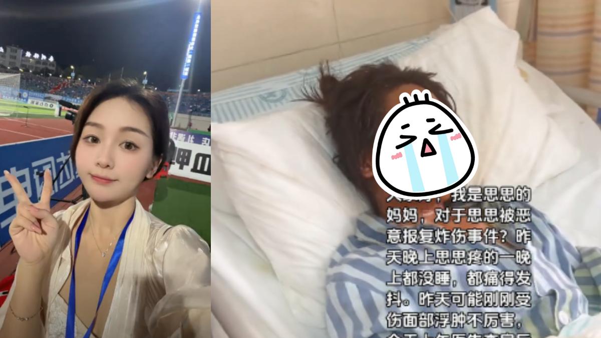 假包裹裝炸彈 陸女直播主一拆被炸到近毀容「眼睛腫剩一條線」