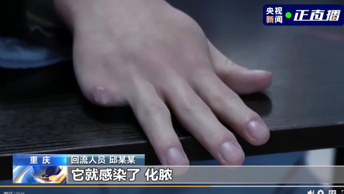 管理人員砍業績沒達標者的手指。(圖/翻攝央視)