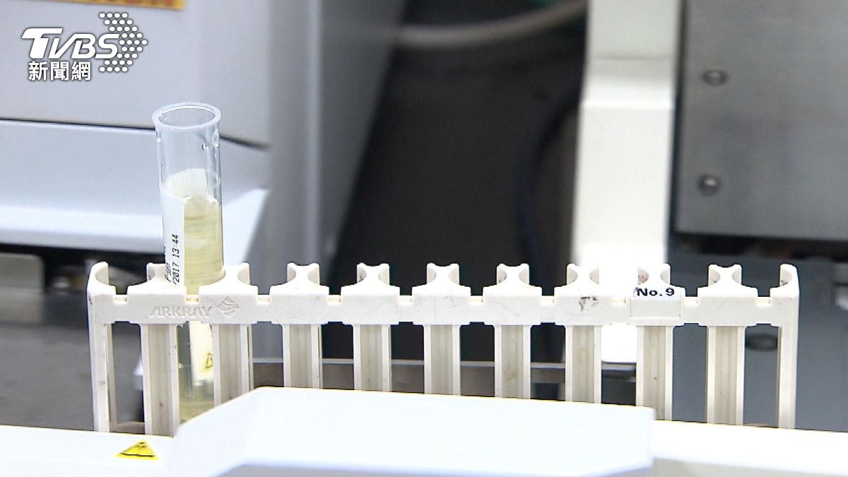 注意!腎臟健康 學者:精準營養飲食管理新趨勢 (圖/TVBS)
