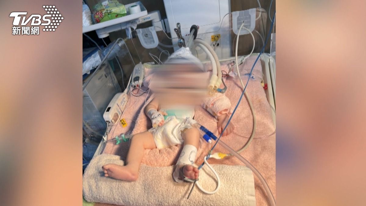 孕婦當下感染A流,指控院方明明胎心異常,卻還不積極處理,導致嬰兒出生後腦性麻痺。(圖/TVBS)