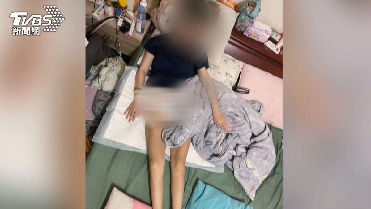 L小姐因對自身體態不滿,花費24萬元進行「SASI縮胃手術」,但術後狀況急劇惡化,確診為維尼克氏腦病變。(圖/TVBS)