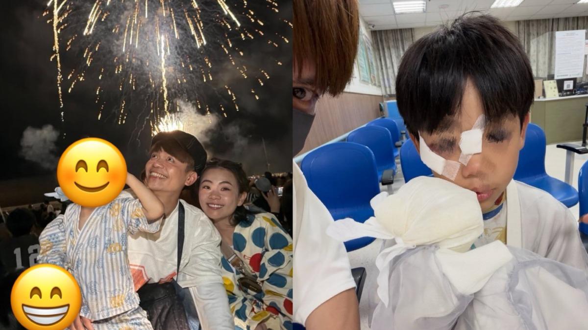 蔡阿嘎7歲兒出事了!蔡桃貴慘跌「臉部掛彩」 送急診縫4針