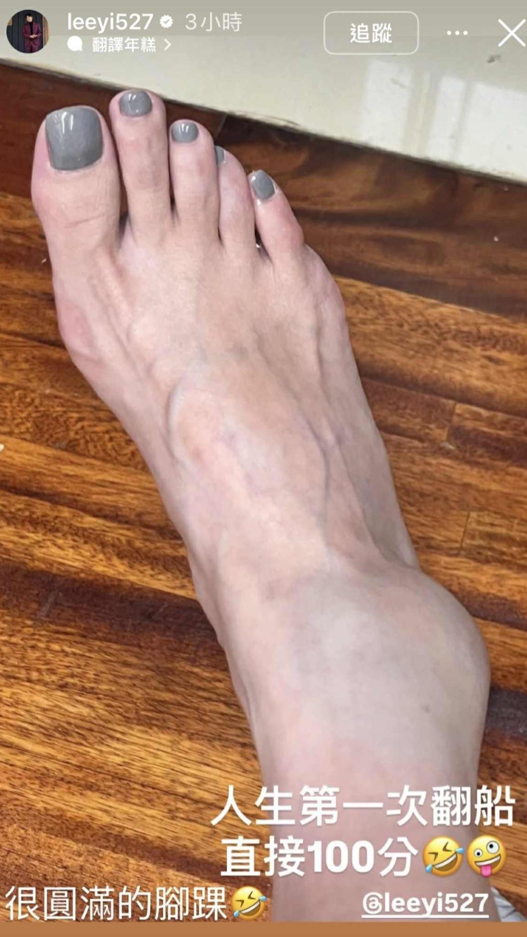 李易玩笑稱六月腳踝「很圓滿」。(圖/翻攝自李易IG)