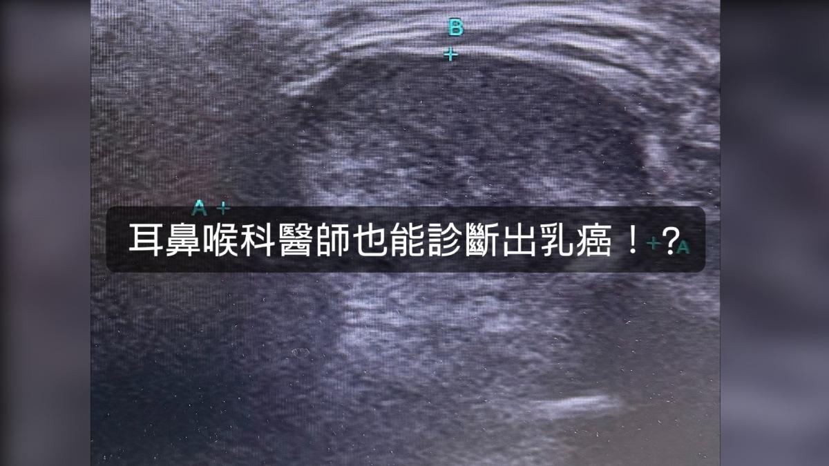 張家豪醫師分享自己遇到乳癌轉移到下頷骨的罕見病例。（圖／張家豪醫師授權提供）