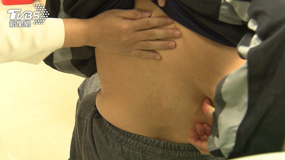 美研究:牙齒沒刷乾淨 罹胰臟癌風險增三倍 (圖/TVBS)